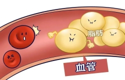 收好這份“血脂達(dá)標(biāo)數(shù)據(jù)”，盡量不給血管添堵